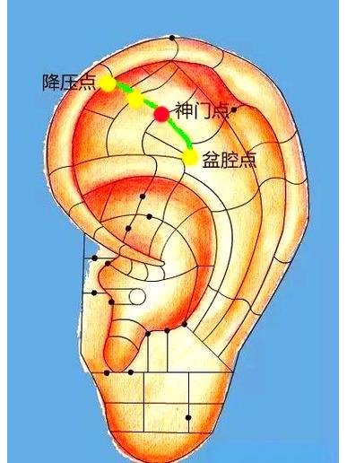 Ear Shenmen acupoint_Baiduwiki
