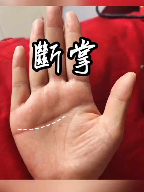 simian line（A type of palm line.）_Baiduwiki