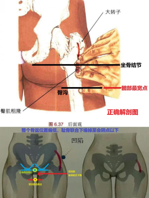 Buttocks（Body part）_Baiduwiki