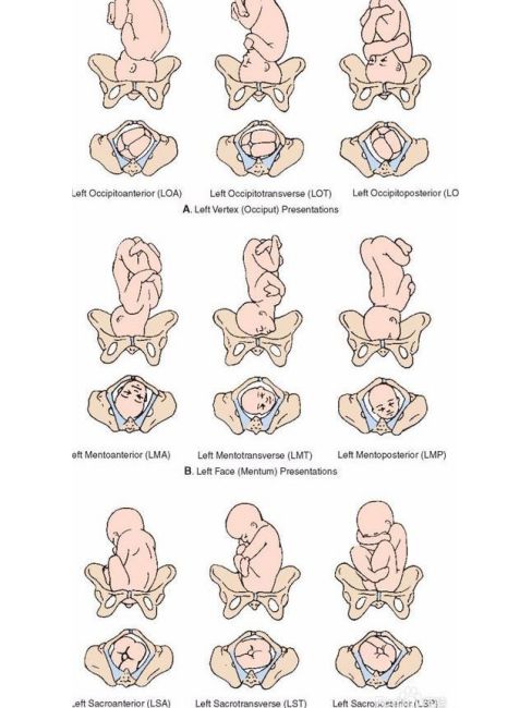 Left Occiput Anterior_Baiduwiki