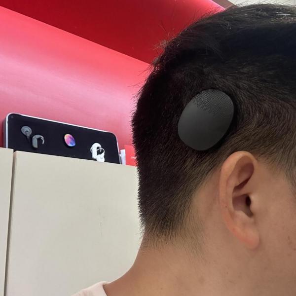 人工内耳_百度百科