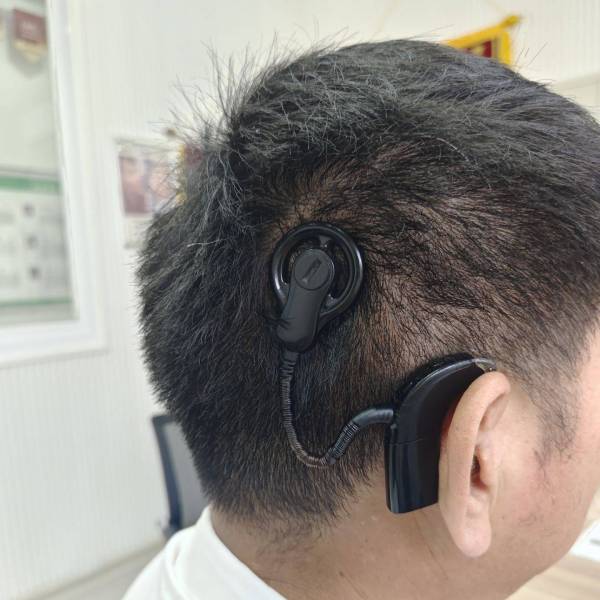 人工内耳_百度百科