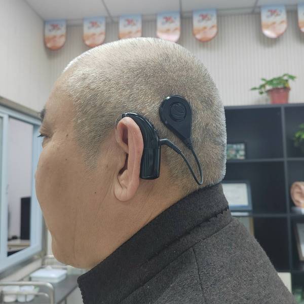 よみがえった音の世界―人工内耳を使用して 人工内耳_百度百科